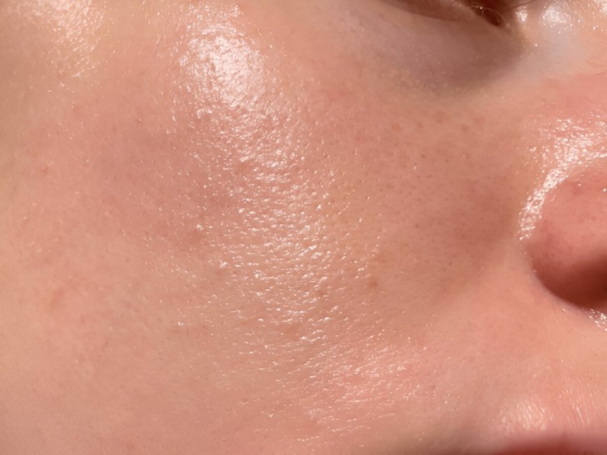 Effective Tips to Combat Oily Skin Without Stripping Its Natural Moisture